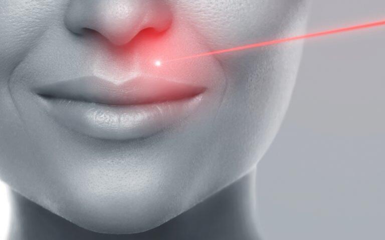 Αποτρίχωση laser. 4 λόγοι για να αλλάξετε το κερί